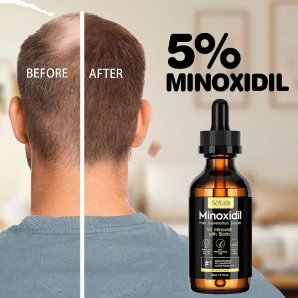 Minoxidil 5% Sérum Capilar e para Barba, 60ml cada, 1 Unidade ou Kit com 3, Sefralls - imagem 2