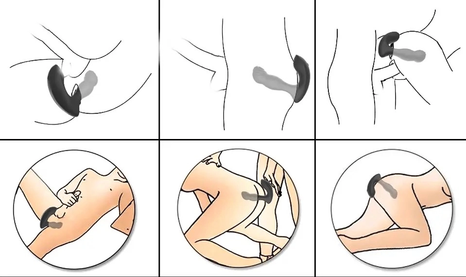 Vibrador Próstata - 2