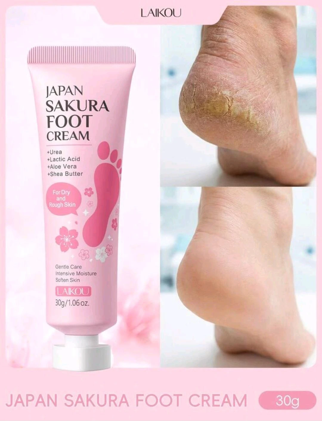 Creme para os Pés Japan Sakura Laikou - Uréia & Karité (30g) 🌸✨ - 1