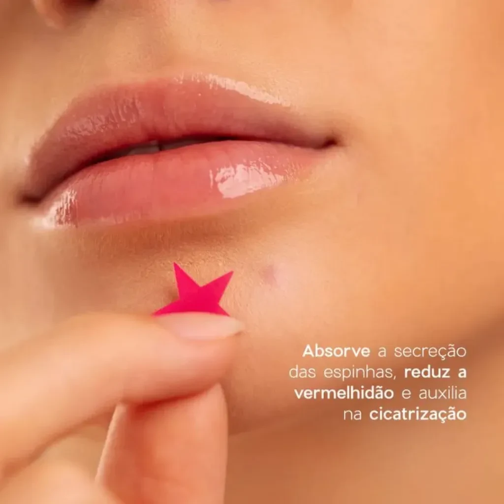 cartela com 40 adesivos para acne patch - 2